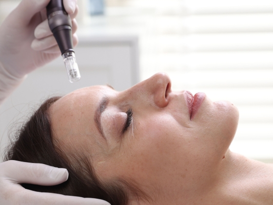 A woman lies with her eyes closed while a gloved hand prepares to perform a microneedling treatment on her forehead, revealing part of The Truth About Anti-Ageing in a professional clinical setting.